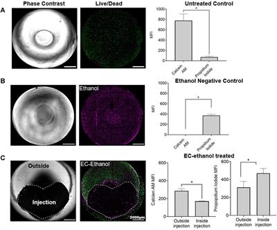 Development of a 3D in vitro human-sized model of cervical dysplasia to evaluate the delivery of ethyl cellulose-ethanol injection